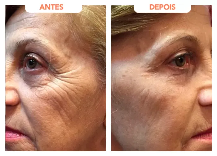 Fotos de antes e depois apresentadas no depoimento de Zuleica Barbosa