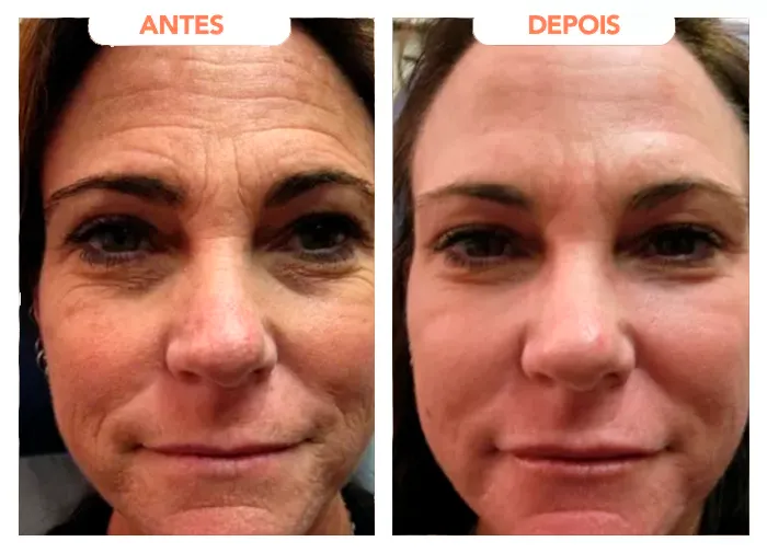 Fotos de antes e depois apresentadas no depoimento de Juliana Silva