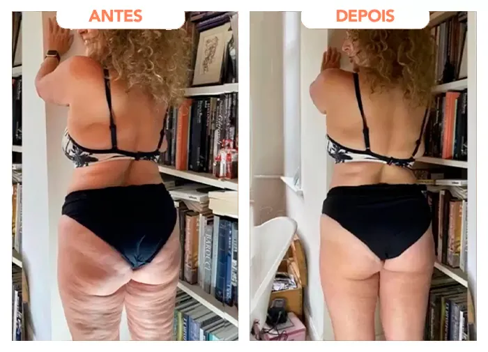 Fotos de antes e depois apresentadas no depoimento de Marli Trentin